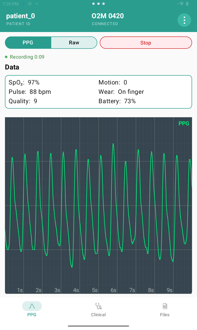 Sympath PPG waveform screen showing live recording
